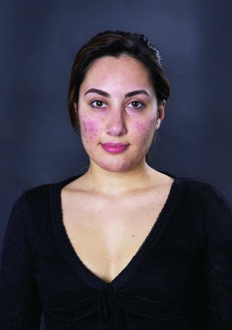 Prima