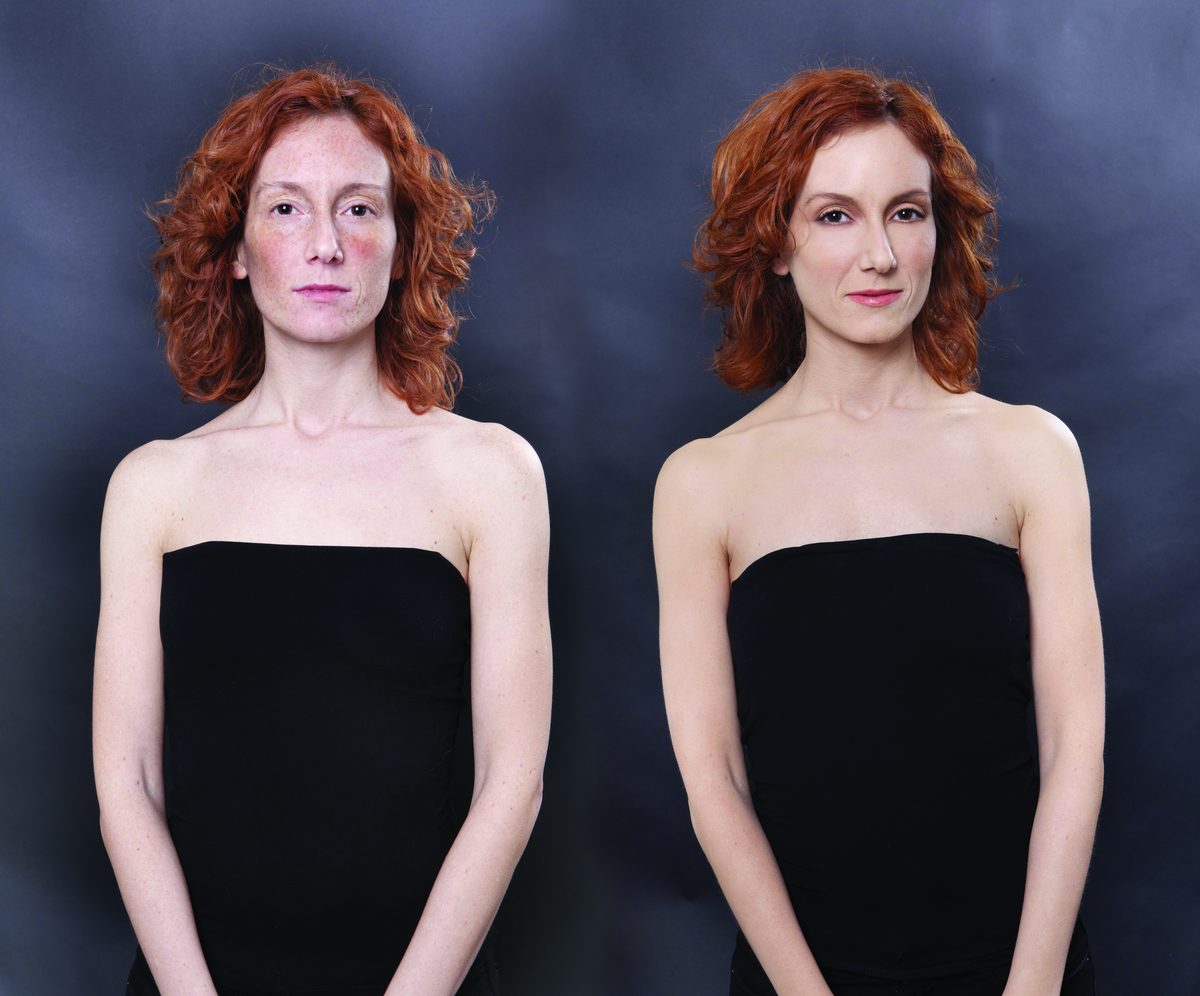 RiparCover before and after on Dark spots & freckles